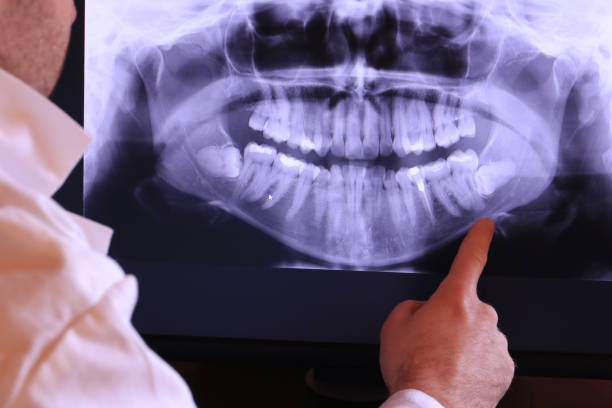 Best Emergency Dentist for Lost Fillings or Crowns in Great Falls Crossing, VA