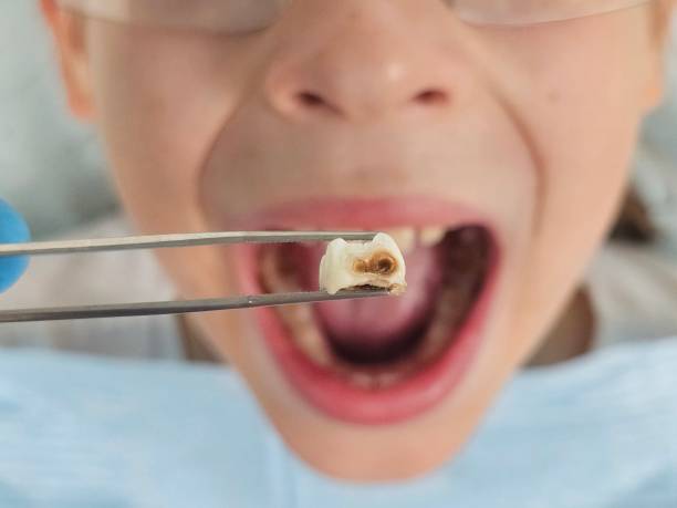 Best Weekend Emergency Dentist in Great Falls Crossing, VA